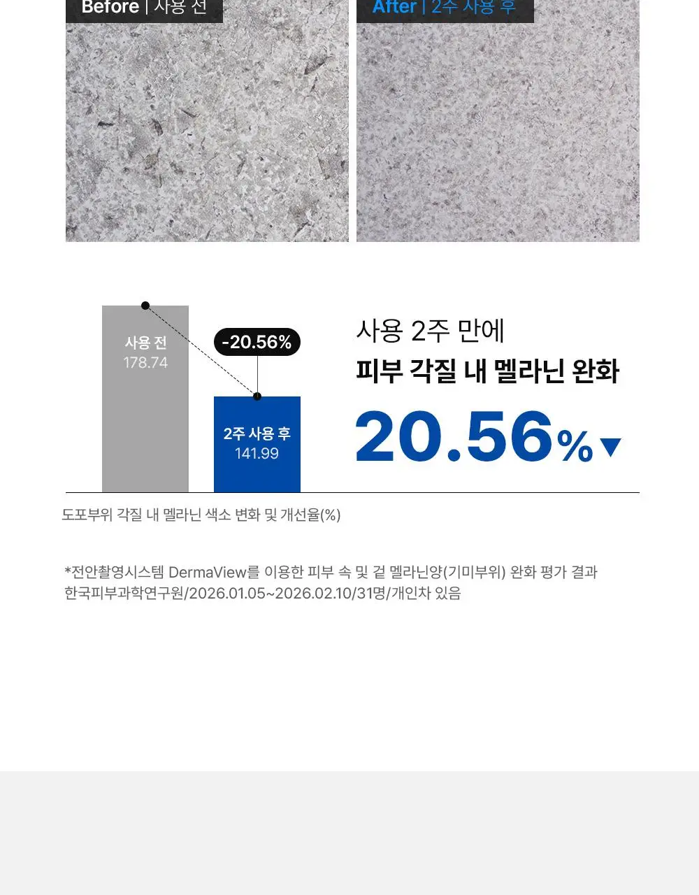 [단독기획] 동아제약 색소침착 프로 크림제 40ml 기획(+5ml*2) 상세페이지 15